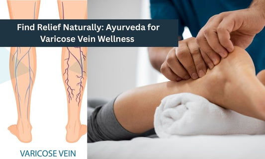 Varicose Veins Treatment in Ayurveda